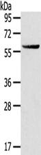 Glutamic--Pyruvic Transaminase antibody, CSB-PA906901, Cusabio, Western Blot image 