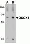 Quiescin Sulfhydryl Oxidase 1 antibody, NBP2-81797, Novus Biologicals, Western Blot image 