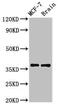 Chromosome 1 Open Reading Frame 56 antibody, CSB-PA871579LA01HU, Cusabio, Western Blot image 