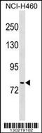 KRIT1 Ankyrin Repeat Containing antibody, MBS9203005, MyBioSource, Western Blot image 
