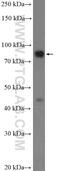 Small G Protein Signaling Modulator 3 antibody, 20825-1-AP, Proteintech Group, Western Blot image 