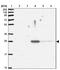 Neuronal Pentraxin 2 antibody, NBP2-31392, Novus Biologicals, Western Blot image 