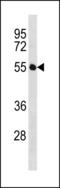 Immunoglobin Superfamily Member 21 antibody, LS-C203855, Lifespan Biosciences, Western Blot image 