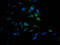 SUMO1 Activating Enzyme Subunit 1 antibody, CSB-RA987582A0HU, Cusabio, Immunofluorescence image 