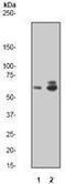 Ribosomal Protein S6 Kinase B1 antibody, GTX61056, GeneTex, Western Blot image 