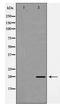 Twist Family BHLH Transcription Factor 1 antibody, TA347922, Origene, Western Blot image 