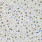 Sequestosome 1 antibody, LS-C746921, Lifespan Biosciences, Immunohistochemistry paraffin image 