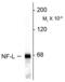Neurofilament Light antibody, GTX82644, GeneTex, Western Blot image 