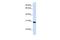 Peroxisomal Biogenesis Factor 11 Alpha antibody, GTX46452, GeneTex, Western Blot image 