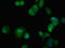 Integrin Subunit Alpha 5 antibody, LS-C672805, Lifespan Biosciences, Immunofluorescence image 