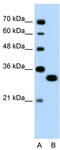 Transcription Factor EC antibody, TA330228, Origene, Western Blot image 