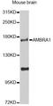 Autophagy And Beclin 1 Regulator 1 antibody, A12578, ABclonal Technology, Western Blot image 