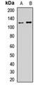 Ubiquitin Specific Peptidase 28 antibody, LS-C668590, Lifespan Biosciences, Western Blot image 