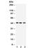 RAGE antibody, R32232, NSJ Bioreagents, Western Blot image 