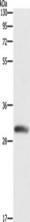 Deoxycytidine Kinase antibody, TA349644, Origene, Western Blot image 