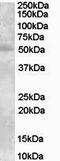 Solute Carrier Family 18 Member A2 antibody, EB06558, Everest Biotech, Western Blot image 