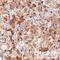 Low Density Lipoprotein Receptor antibody, NBP1-06709, Novus Biologicals, Immunohistochemistry paraffin image 