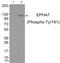 EPH Receptor A7 antibody, 79-944, ProSci, Western Blot image 