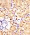 Indian Hedgehog Signaling Molecule antibody, M01448, Boster Biological Technology, Immunohistochemistry paraffin image 