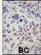 Deubiquitinating enzyme 8 antibody, 61-102, ProSci, Immunohistochemistry paraffin image 