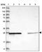 Phosphomannomutase 1 antibody, PA5-56547, Invitrogen Antibodies, Western Blot image 
