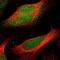 Cyclin Dependent Kinase 14 antibody, PA5-53293, Invitrogen Antibodies, Immunofluorescence image 