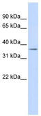 Tripartite Motif Containing 69 antibody, TA337934, Origene, Western Blot image 