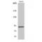 Signal Transducer And Activator Of Transcription 5A antibody, LS-C386219, Lifespan Biosciences, Western Blot image 