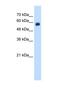 C-Type Lectin Domain Family 4 Member M antibody, NBP1-59182, Novus Biologicals, Western Blot image 