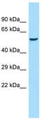 Amylase Alpha 1C (Salivary) antibody, TA335064, Origene, Western Blot image 