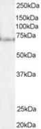 Pescadillo Ribosomal Biogenesis Factor 1 antibody, MBS421128, MyBioSource, Western Blot image 