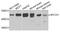 Mitochondrial Carrier 1 antibody, STJ110366, St John