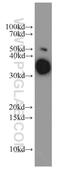 Arginase 1 antibody, 16001-1-AP, Proteintech Group, Western Blot image 