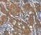 Clathrin Heavy Chain antibody, MBS2518384, MyBioSource, Immunohistochemistry paraffin image 