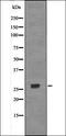 Cyclin Dependent Kinase Inhibitor 1B antibody, orb335719, Biorbyt, Western Blot image 