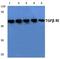 Transforming Growth Factor Beta Receptor 1 antibody, GTX57156, GeneTex, Western Blot image 