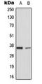 TNF Alpha Induced Protein 1 antibody, LS-C354104, Lifespan Biosciences, Western Blot image 