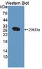 ATP Binding Cassette Subfamily A Member 12 antibody, LS-C374520, Lifespan Biosciences, Western Blot image 