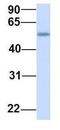 Transmembrane Protein 161A antibody, GTX46324, GeneTex, Western Blot image 