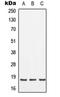 SFT2 Domain Containing 2 antibody, orb215419, Biorbyt, Western Blot image 