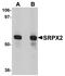 Sushi Repeat Containing Protein X-Linked 2 antibody, NBP1-77370, Novus Biologicals, Western Blot image 