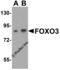 Forkhead Box O3 antibody, 5813, ProSci, Western Blot image 