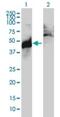Abhydrolase Domain Containing 5 antibody, H00051099-M01, Novus Biologicals, Western Blot image 