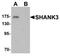 SH3 And Multiple Ankyrin Repeat Domains 3 antibody, TA319075, Origene, Western Blot image 