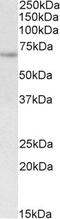 Ubiquitin-associated and SH3 domain-containing protein A antibody, EB10884, Everest Biotech, Western Blot image 