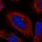 BLOC-1 Related Complex Subunit 6 antibody, HPA060791, Atlas Antibodies, Immunocytochemistry image 