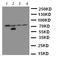 Interleukin 1 Receptor Associated Kinase 1 antibody, LS-C313289, Lifespan Biosciences, Western Blot image 