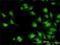 Interleukin 1 Receptor Associated Kinase 1 antibody, H00003654-M02, Novus Biologicals, Immunocytochemistry image 