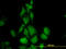TIMP Metallopeptidase Inhibitor 2 antibody, LS-C133482, Lifespan Biosciences, Immunofluorescence image 