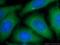 Proteasome 26S Subunit, Non-ATPase 4 antibody, 14899-1-AP, Proteintech Group, Immunofluorescence image 
